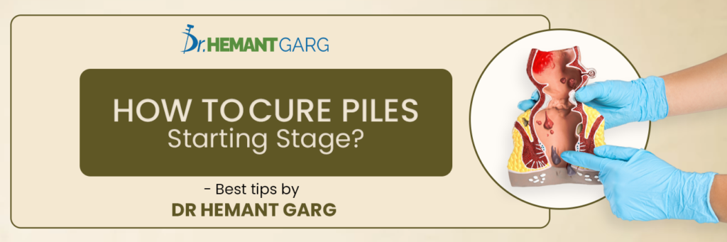 How To Cure Piles Starting Stage?- Best tips by Dr Hemant Garg