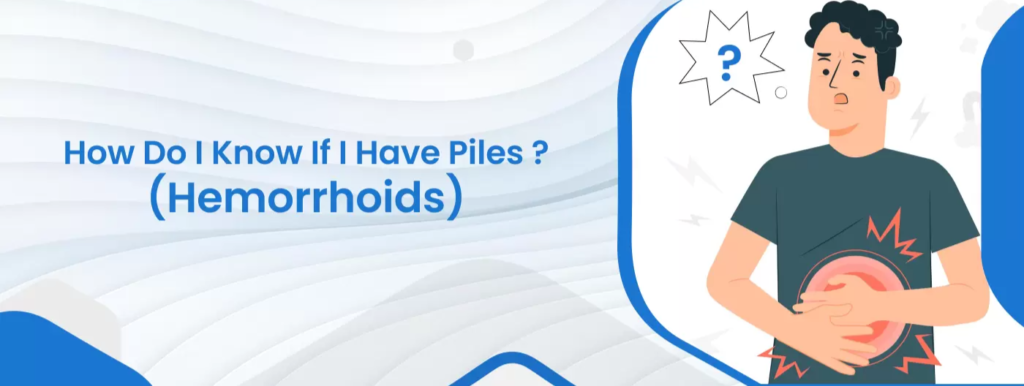 How Do I Know if I Have Piles (Hemorrhoids)?