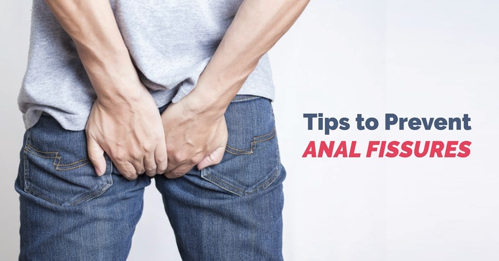 How to prevent anal fissures: Required Tips for a Healthier Digestive System